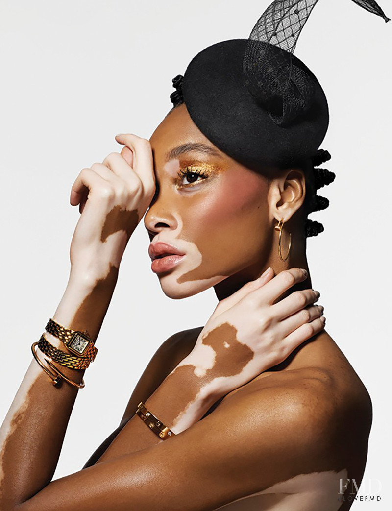 Winnie Chantelle Harlow featured in Winnie Harlow, May 2018