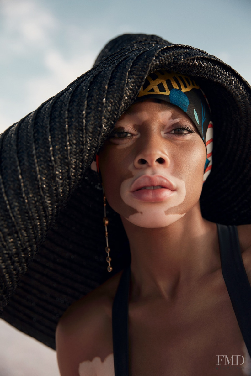 Winnie Chantelle Harlow featured in Winnie Harlow, July 2018