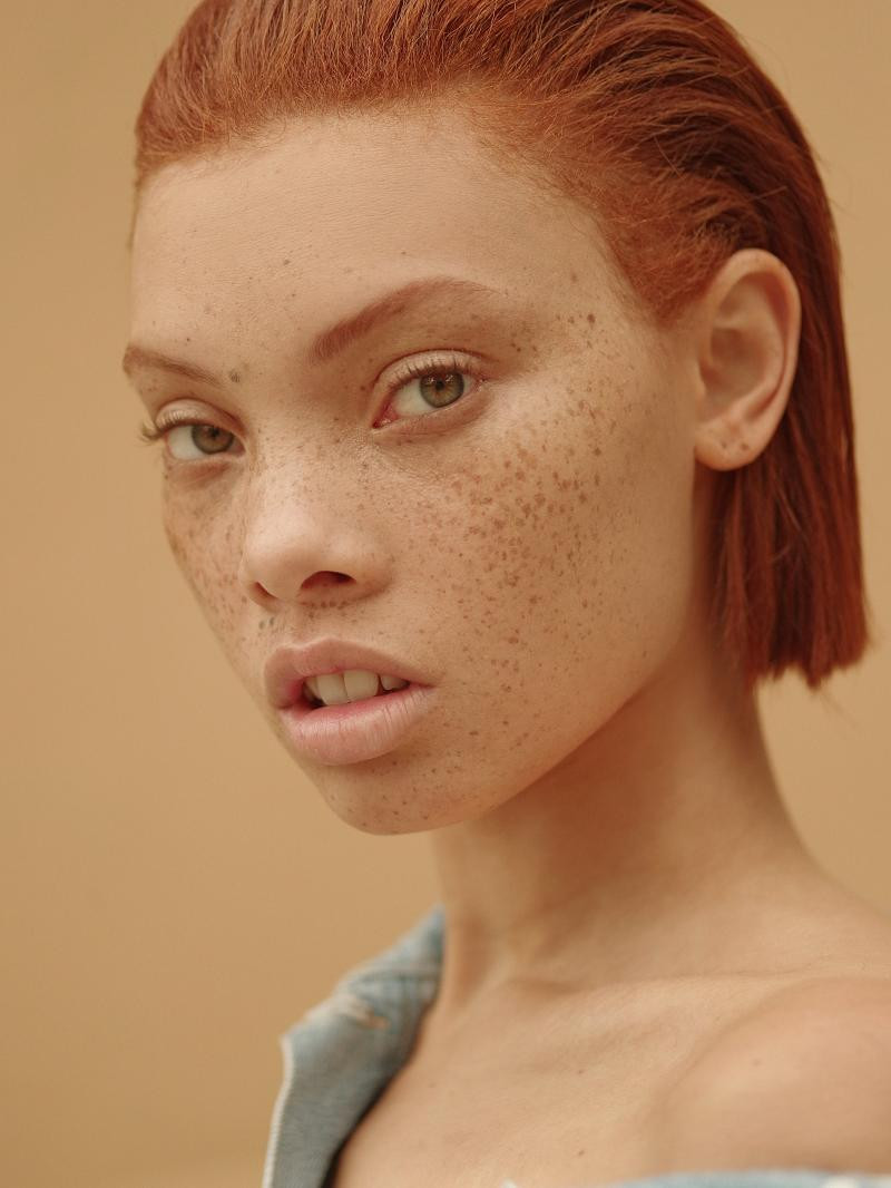 Classify Black Model With Red Hair And Freckles